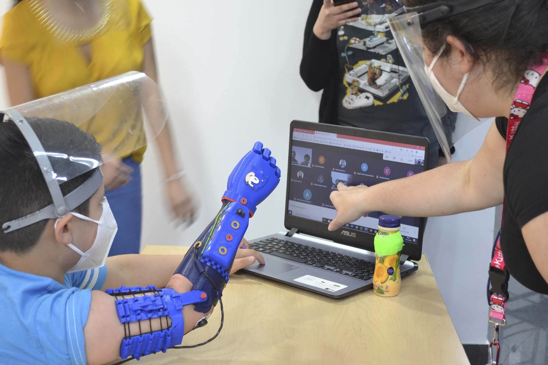 The Peruvian startup designing advanced bionic arm prosthetics